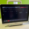 rapid-ecg-testing-device